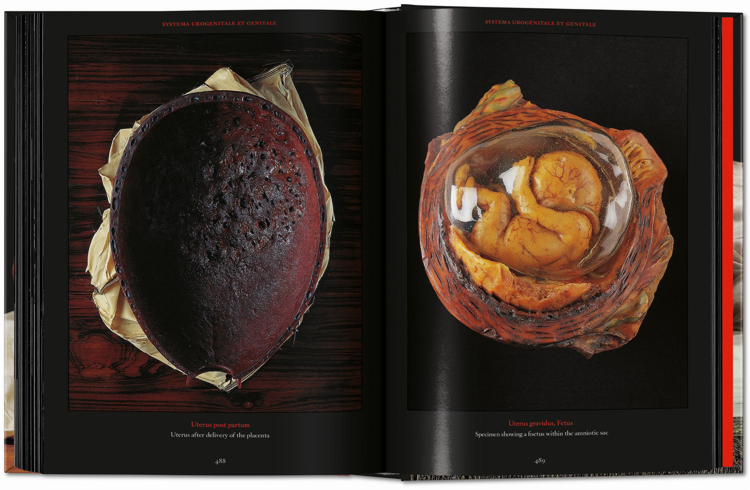 Taschen-Anatomical Waxes. 45th Ed. (German, French, English)-Classics-Black-Deal-Outlet-by-ARCHIVIST